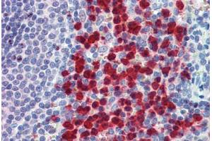 Human Spleen: Formalin-Fixed, Paraffin-Embedded (FFPE) (Cell Adhesion Molecule 4 抗体  (AA 370-384))