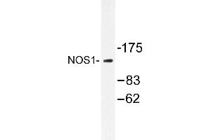 Image no. 1 for anti-Nitric Oxide Synthase 1, Neuronal (NOS1) antibody (ABIN272121) (NOS1 抗体)