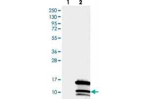 Western blot analysis of Lane 1: Negative control (vector only transfected HEK293T lysate), Lane 2: Over-expression Lysate (Co-expressed with a C-terminal myc-DDK tag (~3. (CCDC23 抗体)