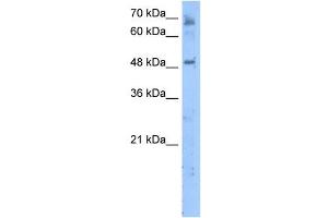 LENG4 antibody used at 5 ug/ml to detect target protein. (MBOAT7 抗体  (C-Term))