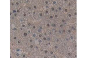 IHC-P analysis of Human Tissue, with DAB staining. (HIST1H2AB 抗体  (AA 2-130))