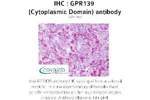 Image no. 2 for anti-G Protein-Coupled Receptor 139 (GPR139) (3rd Cytoplasmic Domain) antibody (ABIN1734944) (GPR139 抗体  (3rd Cytoplasmic Domain))