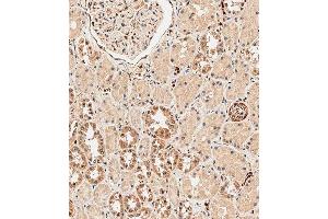 Immunohistochemical analysis of paraffin-embedded human kidney tissue using B performed on the Leica® BOND RXm. (ABCF1 抗体  (C-Term))