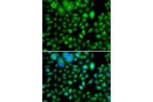 Immunofluorescence analysis of A549 cell using METTL7B antibody. (METTL7B 抗体)