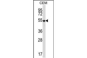 Western blot analysis in CEM cell line lysates (35ug/lane). (GABPA 抗体  (AA 283-311))