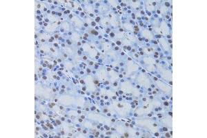 Immunohistochemistry (Paraffin-embedded Sections) (IHC (p)) image for anti-cAMP Responsive Element Binding Protein 1 (CREB1) antibody (ABIN3021674)