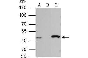 IP Image IDH-1 antibody immunoprecipitates IDH-1 protein in IP experiments. (IDH1 抗体  (Center))