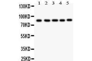 Anti- FOXM1 antibody, Western blotting All lanes: Anti FOXM1  at 0. (FOXM1 抗体  (AA 411-763))