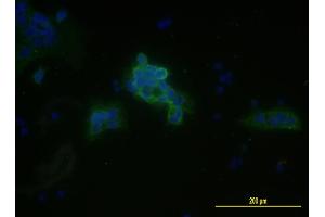 Immunofluorescence of monoclonal antibody to MCAM on JEG-3 cell . (MCAM 抗体  (AA 24-646))