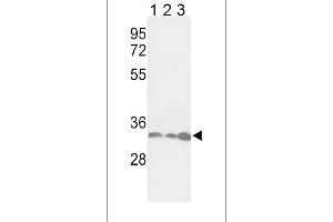 Western blot analysis of PCNA Antibody (Center) (ABIN389345 and ABIN2839454) in Jurkat(lane 1), Hela(lane 2), 293(lane 3) cell line lysates (35 μg/lane). (PCNA 抗体  (AA 89-117))