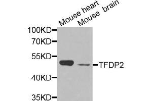 Western blot analysis of extracts of various cell lines, using TFDP2 antibody (ABIN5972290) at 1/1000 dilution. (DP2 抗体)