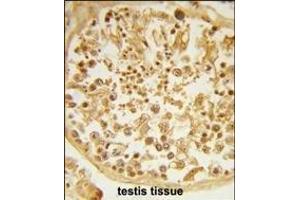 Formalin-fixed and paraffin-embedded human testis tissue reacted with DZIP1 Antibody (Center), which was peroxidase-conjugated to the secondary antibody, followed by DAB staining. (DZIP1 抗体  (AA 568-596))