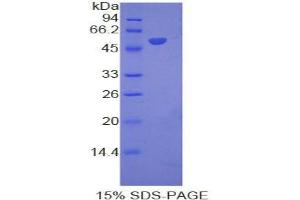 SDS-PAGE analysis of Mouse Interferon alpha 8 Protein. (IFNA8 蛋白)