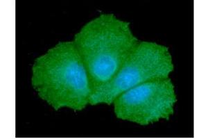 ICC/IF analysis of GALE in Hep3B cells line, stained with DAPI (Blue) for nucleus staining and monoclonal anti-human GALE antibody (1:100) with goat anti-mouse IgG-Alexa fluor 488 conjugate (Green). (GALE 抗体  (AA 1-348))