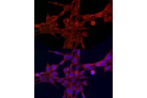 Immunofluorescence analysis of NIH/3T3 cells using SLC27 Rabbit pAb (2847) at dilution of 1:100 (40x lens). (SLC27A1 抗体  (AA 347-646))