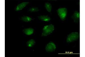 Immunofluorescence of purified MaxPab antibody to CARD9 on HeLa cell. (CARD9 抗体  (AA 1-492))