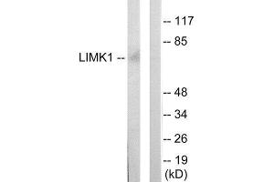 Western Blotting (WB) image for anti-LIM Domain Kinase 1 (LIMK1) (Internal Region) antibody (ABIN1849454) (LIM Domain Kinase 1 抗体  (Internal Region))