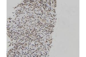 ABIN6267128 at 1/100 staining Human spleen tissue by IHC-P. (JunB 抗体  (pThr102, pThr104))