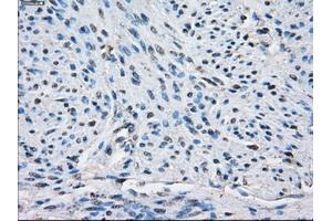 Immunohistochemical staining of paraffin-embedded endometrium tissue using anti-PPP5Cmouse monoclonal antibody. (PP5 抗体)