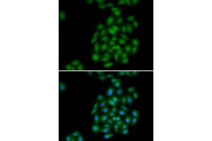Immunofluorescence analysis of HeLa cells using PLSCR1 antibody (ABIN5974037). (PLSCR1 抗体)