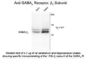 Western Blot of Anti-GABA(A) Receptor beta 1 (Rabbit) Antibody - 612-401-D49 Western Blot of Rabbit anti-GABA(A) Receptor beta 1 antibody. (GABRB1 抗体  (Cytoplasmic Loop))