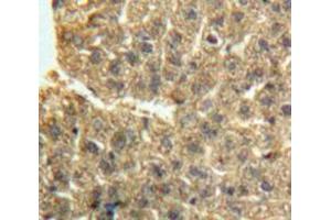 Used in DAB staining on fromalin fixed paraffin-embedded Liver tissue (GDF2 抗体  (AA 241-418))