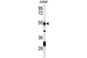 Western blot analysis of PRUNE (arrow) in Jurkat cell line lysates (35ug/lane) using PRUNE  Antibody (C-term). (PRUNE 抗体  (C-Term))
