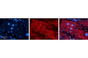 Immunohistochemistry (IHC) image for anti-Cbp/p300-Interacting Transactivator, with Glu/Asp-Rich Carboxy-terminal Domain, 2 (CITED2) (N-Term) antibody (ABIN2776451)