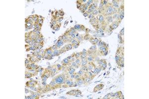 Immunohistochemistry (IHC) image for anti-Synaptotagmin IV (SYT4) (AA 38-190) antibody (ABIN6148791)