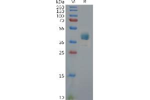 SDS-PAGE (SDS) image for Chemokine (C-X-C Motif) Receptor 3 (CXCR3) (AA 1-53) protein (Fc Tag) (ABIN6964153)