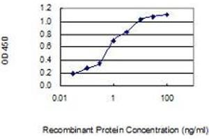 Detection limit for recombinant GST tagged ZNF428 is 0. (ZNF428 抗体  (AA 1-188))