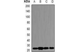 Western blot analysis of PSMB5 expression in Jurkat (A), HepG2 (B), mouse brain (C), mouse kidney (D) whole cell lysates.