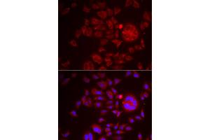 Immunofluorescence (IF) image for anti-serine Peptidase Inhibitor, Kunitz Type 1 (SPINT1) (AA 234-513) antibody (ABIN6148359)