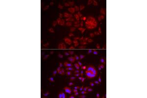 Immunofluorescence analysis of HeLa cells using SPINT1 antibody (ABIN6131743, ABIN6148359, ABIN6148360 and ABIN6222046). (SPINT1 抗体  (AA 234-513))