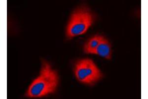 Immunofluorescent analysis of NF1 staining in HeLa cells. (Neurofibromin 1 抗体  (Center))