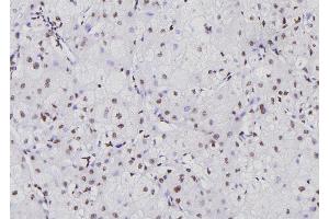 ABIN6276711 at 1/100 staining Human liver tissue by IHC-P.