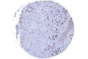 IgA positive plasma cells are numerous in the tonsil (Recombinant 兔 anti-人 IgA Antibody)