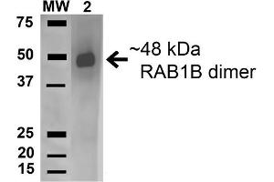 Western blot analysis of Human HeLa and 293Trap cell lysates showing detection of 22. (RAB1B 抗体  (AA 179-189) (PerCP))