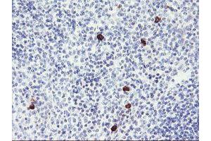 Immunohistochemistry (IHC) image for anti-Ribosomal Protein S6 Kinase, 70kDa, Polypeptide 1 (RPS6KB1) antibody (ABIN1500001) (RPS6KB1 抗体)