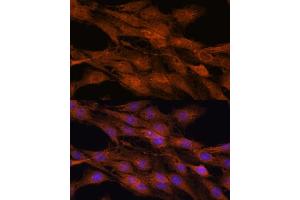 Immunofluorescence analysis of C6 cells using COMMD5 antibody (ABIN7266471) at dilution of 1:100. (COMMD5 抗体  (AA 1-224))