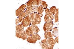 Paraformaldehyde-fixed, paraffin embedded Human skeletal muscle tissue, Antigen retrieval by boiling in sodium citrate buffer (pH6. (ATG3 抗体)