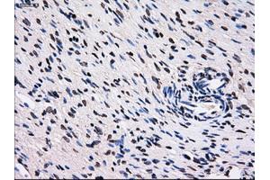 Immunohistochemical staining of paraffin-embedded colon tissue using anti-RPA2 mouse monoclonal antibody. (RPA2 抗体)