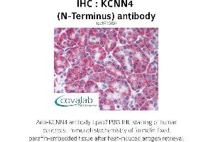 Image no. 1 for anti-Potassium Intermediate/small Conductance Calcium-Activated Channel, Subfamily N, Member 4 (KCNN4) (N-Term) antibody (ABIN1736196) (KCNN4 抗体  (N-Term))