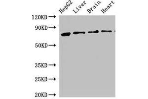 Western Blot Positive WB detected in: HepG2 whole cell lysate, Rat liver tissue, Rat brain tissue, Mouse heart tissue All lanes: KLKB1 antibody at 2. (KLKB1 抗体  (AA 503-612))