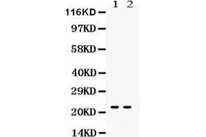 Observed bind size: 22KD (Lipocalin 2 抗体  (AA 21-200))