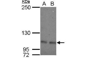 WB Image Sample (30 ug of whole cell lysate) A: 293T B: A431 5% SDS PAGE antibody diluted at 1:500 (OCRL 抗体  (C-Term))