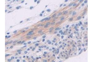 Detection of ADCY6 in Mouse Uterus Tissue using Polyclonal Antibody to Adenylate Cyclase 6 (ADCY6)