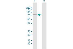 Western Blot analysis of IGF2BP2 expression in transfected 293T cell line by IGF2BP2 MaxPab polyclonal antibody.