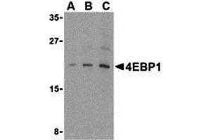 Western Blotting (WB) image for anti-Eukaryotic Translation Initiation Factor 4E Binding Protein 1 (EIF4EBP1) (C-Term) antibody (ABIN1030211) (eIF4EBP1 抗体  (C-Term))