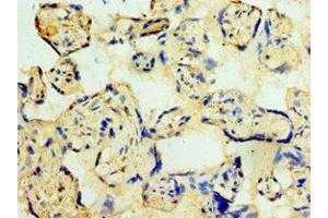 Immunohistochemistry of paraffin-embedded human placenta tissue using ABIN7148860 at dilution of 1:100 (CDK16 抗体  (AA 277-496))